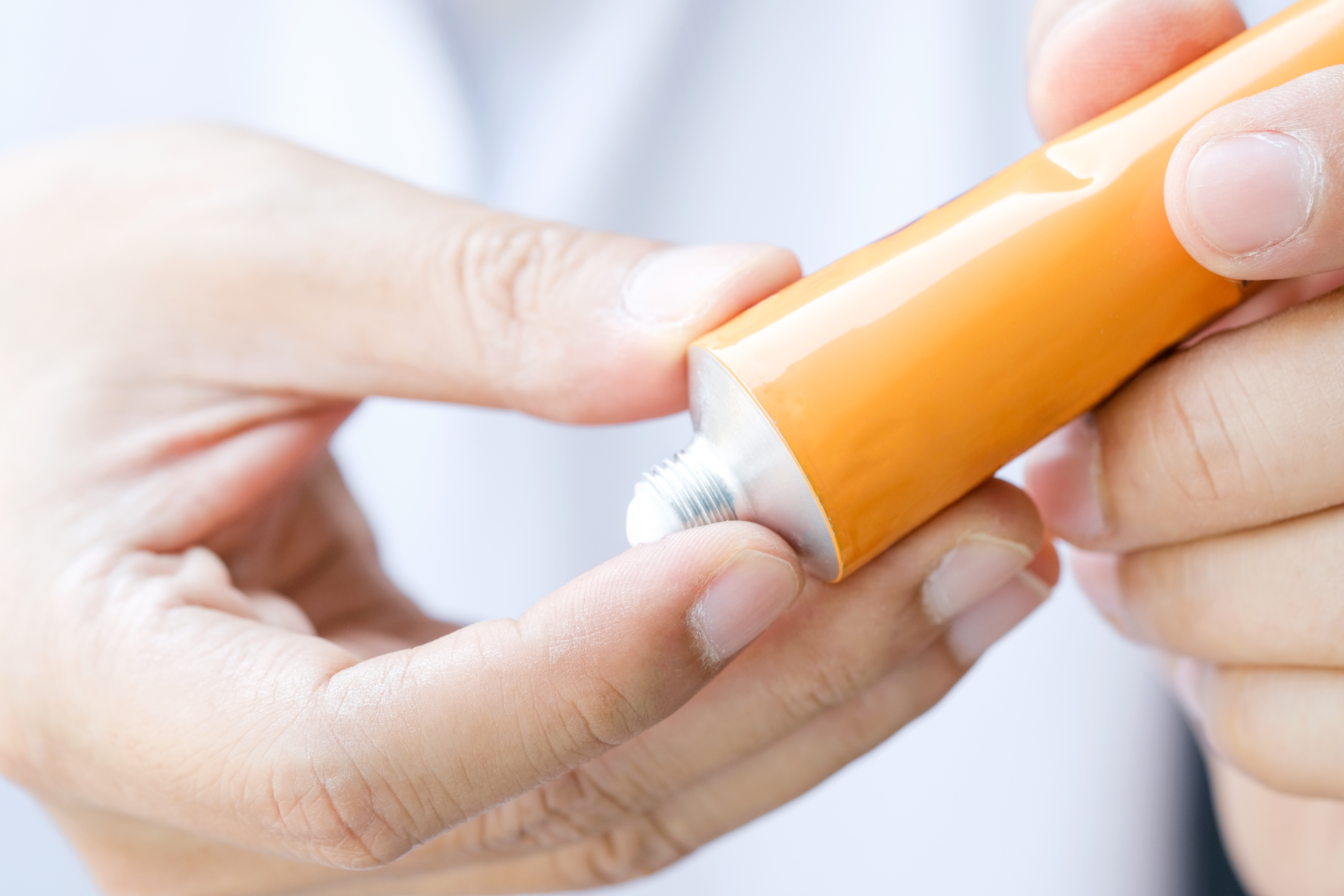 Man's hand applying topical cream from tube